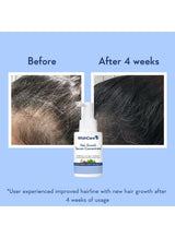 WishCare Hair Growth Serum Concentrate | Redensyl, Anagain, Baicapil, Rosemary, Caffeine, Biotin & Rice Water | Advanced Serum for Scalp | Controls Hairfall & Boosts New Growth | In-Vivo Tested | For Men & Women 5