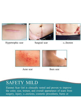 BUPY Silicone Scar Sheets,Effective Safe Breathable Comfortable Long-Lasting Results Scar Care Adopt Advanced Technology to Improve Heal and Lighten Scars for Old and New Scars 4cm*1.5m 4