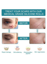 BUPY Silicone Scar Sheets,Effective Safe Breathable Comfortable Long-Lasting Results Scar Care Adopt Advanced Technology to Improve Heal and Lighten Scars for Old and New Scars 4cm*1.5m 2