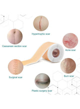 BUPY Silicone Scar Sheets,Effective Safe Breathable Comfortable Long-Lasting Results Scar Care Adopt Advanced Technology to Improve Heal and Lighten Scars for Old and New Scars 4cm*1.5m 3