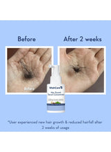 WishCare Hair Growth Serum Concentrate | Redensyl, Anagain, Baicapil, Rosemary, Caffeine, Biotin & Rice Water | Advanced Serum for Scalp | Controls Hairfall & Boosts New Growth | In-Vivo Tested | For Men & Women 4